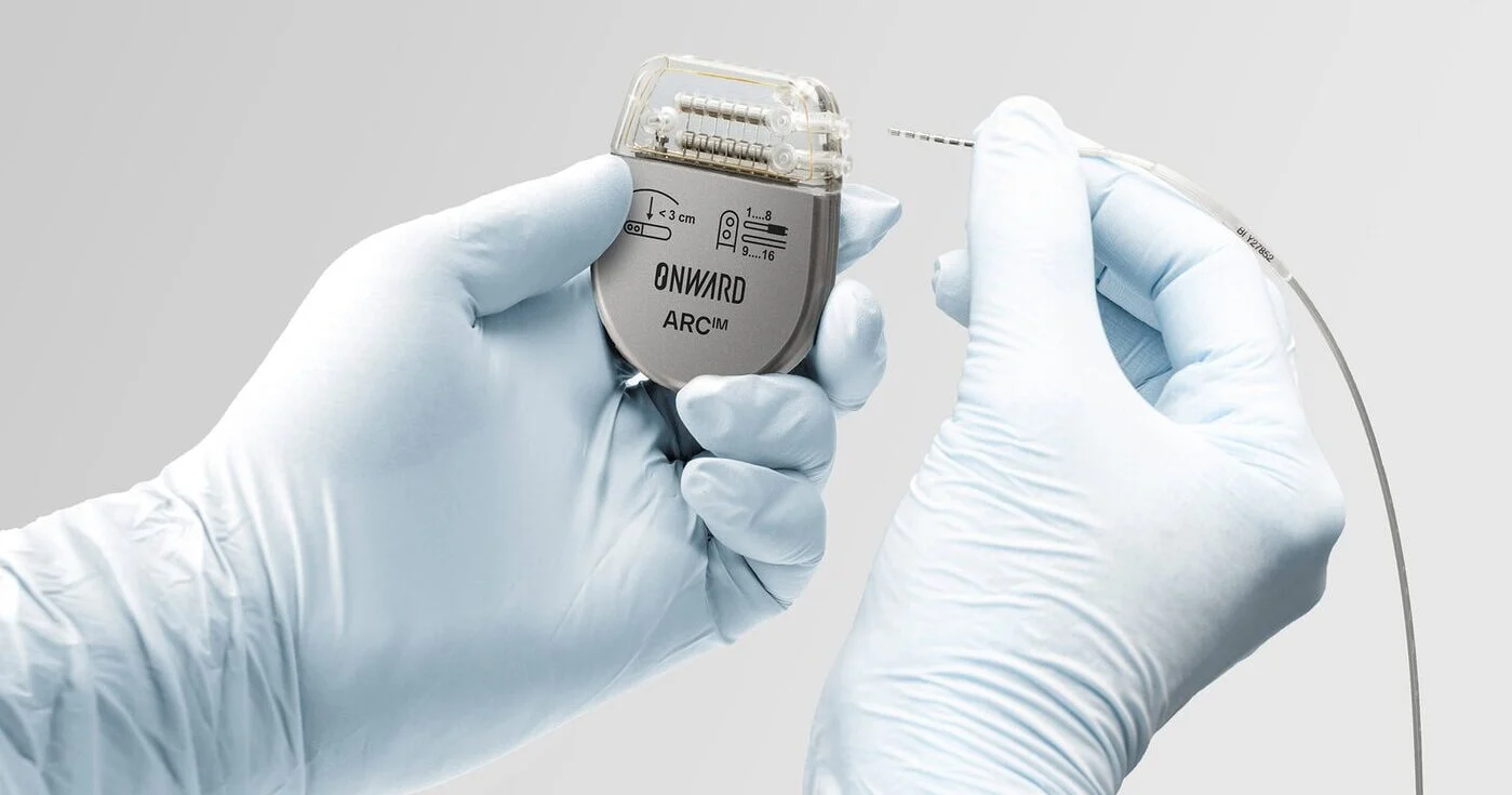 ONWARD Studies Implanted System for Blood-Pressure Problems After Spinal Cord Injury